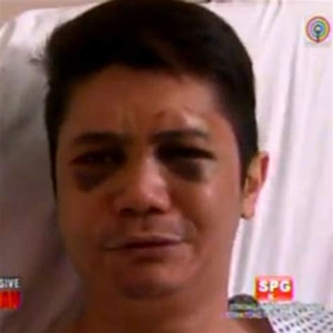 vhong navarro bugbog|Vhong Navarro Reveals Details behind Mauling Incident.